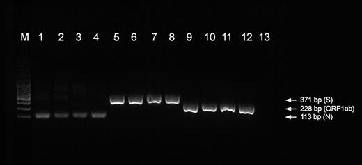 Image showing simplex PCR amplification products at 113 bp for N gene (lanes 1–4), 228 bp for ORF1ab gene (lanes 5–8), and 371 bp for S gene (lanes 9–12). Lane M: molecular ladder 100 bp. Lane 13: no template control.