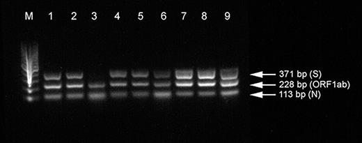 Gel electrophoresis for triplex PCR, using the selected primers and DreamTaq Green PCR master mix. Lane M: molecular ladder 100 bp. Lanes 1–9: PCR amplification products for clinical samples.