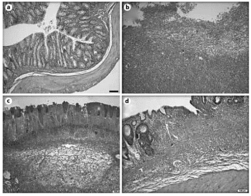Fig. 1. Sections of colonic samples taken at 7 days from rats receiving saline (a), TNBS (b), TNBS + methylprednisolone (c) and TNBS + rivaroxaban (d). a Colonic segment with normal morphology. b Severe and full thickness inflammation, extensive and full thickness necrosis and a large superficial ulceration. c Moderate inflammation involving mucosa and submucosa and moderate necrosis. d Moderate inflammation involving mucosa and submucosa and crypt distortion as an indicator of chronic epithelial cell damage. HE. ×25.