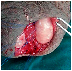 Fig. 2. One testicle is laid down after being fixed with sutures and the other one was tied down, confirming good vascularity of both testicles.