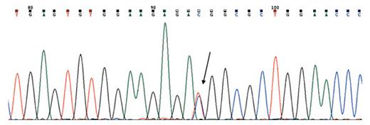 Fig. 2. Sanger sequencing showing c.-14C>T mutation in the IFITM5 gene.