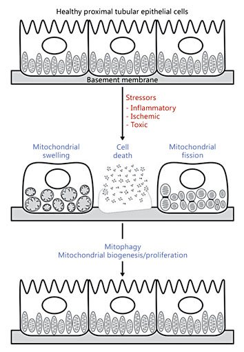 Fig. 1. In AKI, mitochondria within the proximal tubular epithelial cells undergo swelling, fission, and/or cell death. The clearance of damaged mitochondria (mitophagy) and generation of healthy organelles (mitochondrial biogenesis) may contribute to recovery.