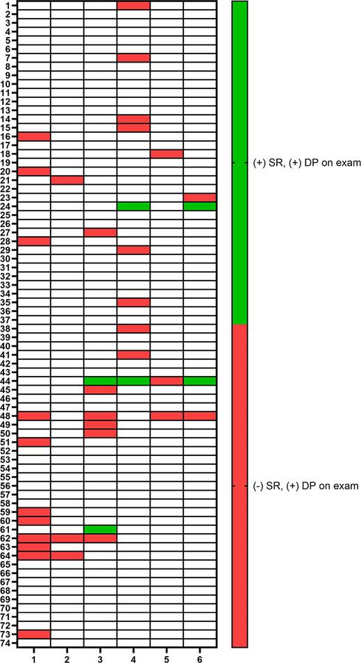 Limb dystonia: concordance across time between self-reported dystonia and DOE. Columns represent the assessments over time. Rows represent cases with self-report and dystonic postures on exam. SR, self-reported dystonia; DOE, dystonia on examination.