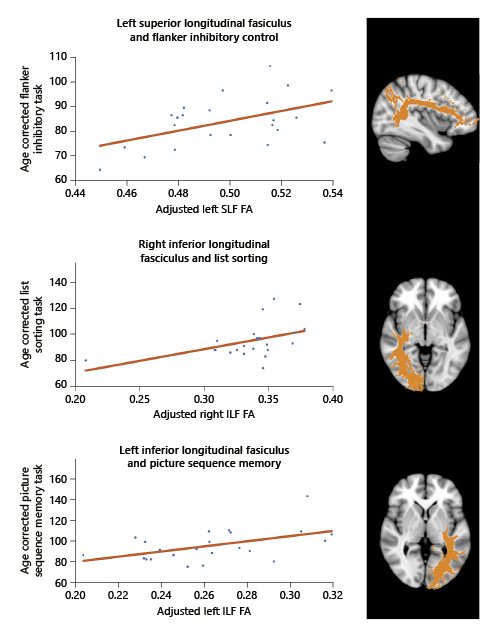 Fig. 4. Graph of white matter tract FA values with scores on cognitive tasks. The top panel shows the relationship between the left SLF FA values and the age-corrected score of the flanker inhibitory test, which measures both executive function and attention. The middle and bottom panels show the relation between the right and left ILF FA values and tests of working (list sorting) and episodic memory (picture sequence), respectively. The FA values are adjusted for age, and a higher FA indicates better white matter integrity. The cortical images on the right outline the respective tracts. FA, fractional anisotropy; SLF, superior longitudinal fasciculus; ILF, inferior longitudinal fasciculus.