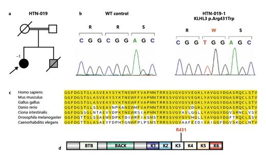 Fig. 1. a Pedigree of kindred HTN-019. Arrow points to the index case. Female subjects are shown as circles, and male subjects as squares. Double line indicates consanguinity. Slashes through symbols indicate deceased individuals. Black symbol, affected; white symbol, unaffected; gray symbol: status unknown. b Sanger sequences of HTN-019-1 and of an unrelated WT control. Encoded amino acids are shown in one-letter code above, with the mutant amino acid in red. c Alignment of orthologs in different species (top) demonstrates conservation of Arg431. d Location of the mutant residue in a cartoon of human KLHL3, with Kelch-like repeats (K1–K6) displayed in different colors. Also shown are BTB and BACK domains (see text).