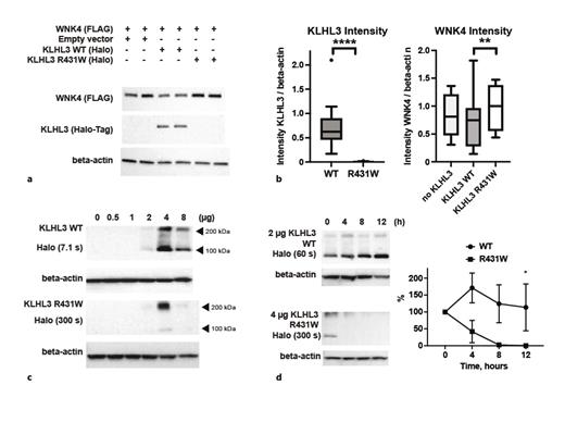 Fig. 3. a Representative Western blots of cell lysates transfected with WNK4 and empty vector, WT or p.Arg431Trp (R431W) KLHL3. b Box and whisker plots (Tukey) with quantitation of the results from 12 experiments, using two independent clones of each plasmid. **, p= 0.0046; ****, p&lt; 0.0001 (two-tailed ratio-paired t tests). c Representative Western blots of cell lysates transfected with increasing amounts of WT or R431W KLHL3. Note the different exposure times for WT and R431W. The lower and upper HaloTag-positive bands may reflect the KLHL3 monomer and dimer, respectively. d Representative Western blots of cells transfected with 2 µg WT or 4 µg R431W KLHL3 plasmid, treated with cycloheximide, and lysed at the indicated time points. Note the different exposure times. Analysis of 2 biological replicates with 2 technical replicates each shows decreased stability of mutant protein, normalized to beta-actin and time point 0 h (mean ± SD). At 12 h, significantly less R431W than WT protein is present (Mann-Whitney test, *, p= 0.029).