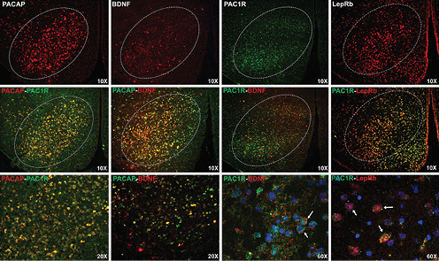 Fig. 2. Fluorescent photomicrographs of mRNA expression in the VMN (bregma = 2.5–2.7 mm) for PACAP, BDNF, PAC1R, and LepRb (top row) at 10× magnification. Second row: 10× images illustrate co-expression of PACAP/PAC1R, PACAP/BDNF, PAC1R/BDNF, and PAC1R/LepRb in cells of the VMN. Label colors correlate with similarly colored fluorophores. Third row: higher magnification images of PACAP/PAC1R, PACAP/BDNF (20×), PAC1R/BDNF, and PAC1R/LepRb (60×). The 60× images show co-expression PAC1R, BDNF, and LepRb in DAPI-delineated cells. Arrows identify examples of DAPI-labeled cells showing co-expression.