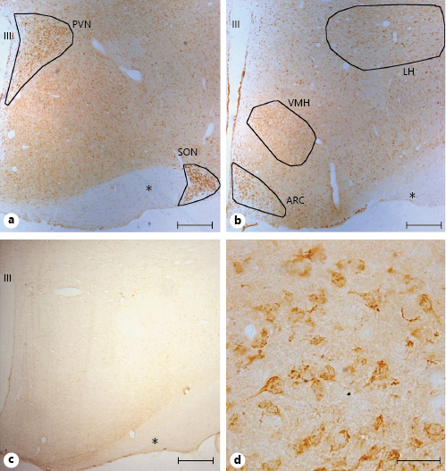 Representative examples of GPER immunohistochemical localization in rat hypothalamic sections. GPER immunoreactivity was widely distributed in the hypothalamus. a GPER-immunoreactive cells were detected in the paraventricular nucleus (PVN) and supraoptic nucleus (SON). b GPER immunoreactivity in the lateral hypothalamus (LH), ventromedial hypothalamus (VMH), and arcuate nucleus (ARC) among other hypothalamic regions. c GPER immunostaining using a preabsorbed antibody with the specific blocking peptide. d At high magnification immunoreactivity showed a cytoplasmic localization. All figures are from females in estrus. Asterisks denote optic fibers. Scale bars, 200 µm in a, b, and d and 20 µm in c. GPER, G protein-coupled estrogen receptor 1; III, third ventricle.