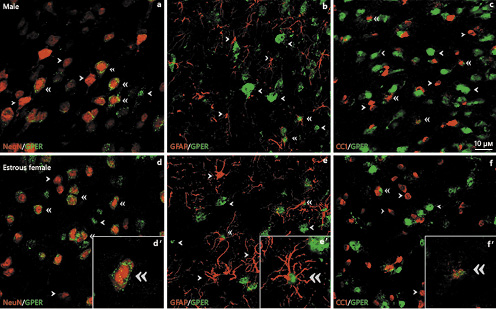 Representative examples of GPER colocalization with neuronal (NeuN) (a, d), astroglial (GFAP) (b, e), and oligodendroglial (CC1) (c, f) cell markers in the arcuate nucleus of the rat hypothalamus of male (a–c) and estrous female (d–f) rats. Single arrowheads point to representative single-labeled cells. Double arrowheads point to representative double-labeled cells. Insets show examples of double-labeled cells at high magnification. Scale bar, 10 µm. GPER, G protein-coupled estrogen receptor 1.