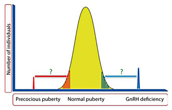 Fig. 5. Genetics of puberty.The precise genetic basis of the extreme tails of normal puberty is unclear. The genetic variants causing GnRH deficiency and precocious puberty may possibly explain the heritability of early and delayed puberty in the normal population.