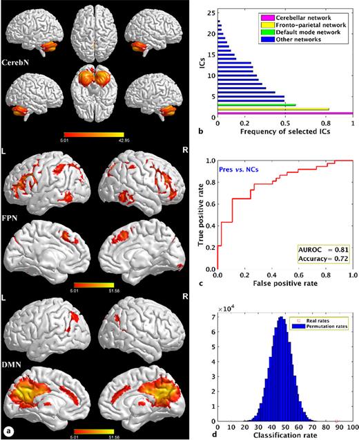 Three informative functional brain networks identified by the multivariate pattern classification method and the classification performance. a Three highly selected functional brain networks, including CerebN, FPN, and DMN, for differentiating active CD patients from NCs. b The frequency of the functional brain networks selected in the nested LOOCV experiments. c The receiver operating characteristic (ROC) curve (area under the ROC curve [AUROC] = 0.81) of the classification model built upon the selected most discriminative FNs. d The histogram of the classification rates of the permutation tests and the real classification rate. In panel (a), brain regions with significant functional connectivity were obtained by applying voxel-wise one-sample t tests to the IC’s z scores for each of the FNs across all active CD patients and NCs (p < 0.05, FWE corrected for multiple comparisons, and cluster size >400 voxels). CerebN, cerebellar network; FPN, fronto-parietal network; DMN, default mode network; CD, Cushing’s disease; Pres, CD patients before treatment (i.e., active CD patients); NCs, normal controls; FNs, functional networks; ICs, independent components; FWE, family-wise error; L, left; R, right.