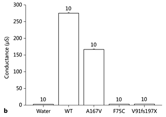 Fig. 1. a Averaged current/voltage curves obtained in Xenopus oocytes injected with 2 ng WT or mutant KCNJ10 cRNA. Oocytes expressing KCNJ10 F75C and V91fs197X are indistinguishable from water-injected oocytes. Oocytes were held in 20 mM K+ at -40 mV and clamped from +100 to -100 mV in 20 mV steps. Note that currents reversed around -40 mV due to the 20-mM K+ solution used. Three batches of oocytes were analysed. b Analysis of the chord conductance between -100 and 0 mV. c Barium (100 μM) inhibited more strongly the inward component of WT and A167V mutant currents.