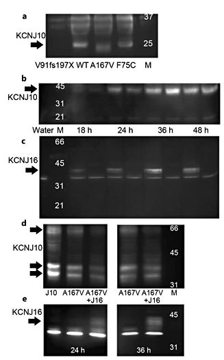 Fig. 4. a KCNJ10 WT, A167V, F75C and V91fs197X expressed in oocytes, separated by SDS-PAGE and probed for KCNJ10. Note that V91fs197X cannot be detected with our antibody as it recognizes an epitope lost through frameshift in this mutation, suggesting the antibody is specific. b, c Time-course of expression of 1 ng KCNJ10 and 3 ng KCNJ16 cRNA co-expressed in oocytes over 48 h. Detection in membrane preparations with a monoclonal antibody against KCNJ10 (b), and with a polyclonal antibody against KCNJ16 (c). d Western blot probed for KCNJ10 prepared from oocytes expressing KCNJ10 A167V with and without KCNJ16. e Same membrane as in d, probed for KCNJ16. Expression levels appear somewhat lower for KCNJ10 A167V, but the co-expression with KCNJ16 does not alter expression significantly, suggesting that overall stability of KCNJ10 A167V is unaltered by heteromerisation with KCNJ16. KCNJ10 is known to produce multiple bands on Western blotting, depending on the preparation [34]. Note that the lane description applies for d and e. Arrows indicate specific bands throughout the figure, and M indicates molecular weight marker lanes with the approximate molecular weight given in kDa.
