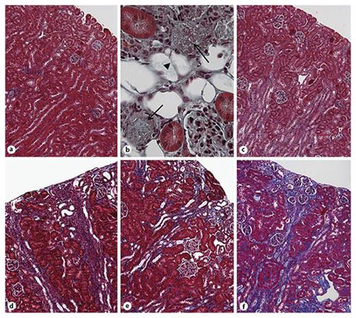 Fig. 1. Masson’s Trichrome staining of kidneys from male C57BL/6 mice treated with AAI at varying dose and frequency. a Control. b 10 mg/kg single dose (×400 magnification). c 2.5 mg/kg once every 2 weeks for 4 weeks. d 2.5 mg/kg/week for 4 weeks with 1 week of disease development time. e 2.5 mg/kg/week for 4 weeks with 4 weeks of disease development time. f 3 mg/kg once every 3 days for 6 weeks with 6 weeks of disease development time. Magnification is ×100 unless stated.