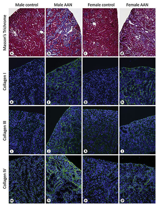 Fig. 5. Masson’s Trichrome (×100) and immunofluorescent staining of collagens (×200). Male (left hand columns) and female (right hand columns) mice were treated with 3 mg/kg of AAI for 6 weeks and then maintained for a further 6 weeks. Paraffin sections were stained with Masson’s Trichrome (a–d), collagen I (e–h), collagen III (i–l) and collagen IV (m–p). Nuclei were stained with DAPI.