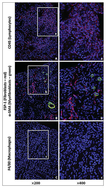 Fig. 7. Immunofluorescent staining of infiltrating inflammatory cells and fibroblasts in the AAN kidney. 4 µm thick sections from 12-week-old male AAN mice were stained with CD45 (A), S100A4 in red and α-SMA in green (B), and F4/80 (C). Nuclei were stained with DAPI. Boxed area on ×200 image is shown at ×400 magnification in the right column.