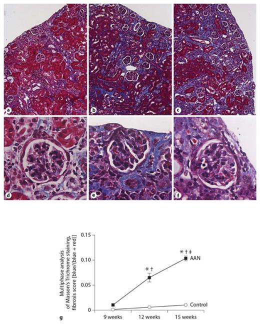 Fig. 9. Masson’s Trichrome staining in male mice with the progression of AAN. Male mice were treated with either AAI for 3 weeks followed by 6 weeks remodelling time (9 weeks), AAI for 6 weeks followed by 6 weeks remodelling time (12 weeks) or AAI for 6 weeks followed by 9 weeks remodelling time (15 weeks). The development of kidney fibrosis is shown by Masson’s Trichrome-stained slides (a–f). Quantification of Masson’s Trichrome staining (g) was assessed by multiphase image analysis of 10 fields per section. Data represent mean ± SEM; n = 5–10 per group. * Indicates statistical significance compared to the control group. † and ‡ indicate changes from 9 and 12 weeks AAN groups, respectively.