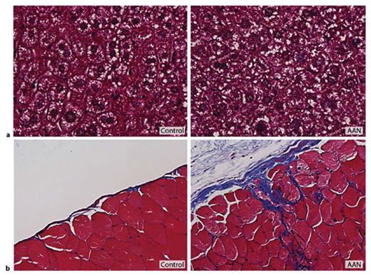 Fig. 10. Masson’s Trichrome staining of liver (a) and peritoneum (b). 4 µm thick sections from 12-week-old male mice treated with AA1 were stained with Masson’s Trichrome (×400 magnification).