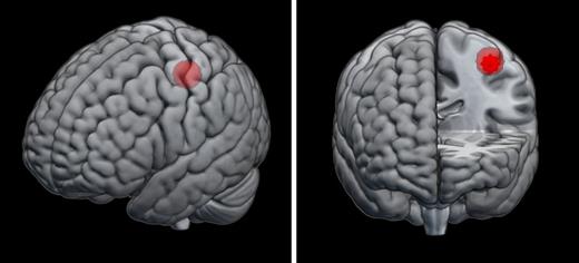 Location of M1 sphere in the Montreal Neurological Institute standard space.