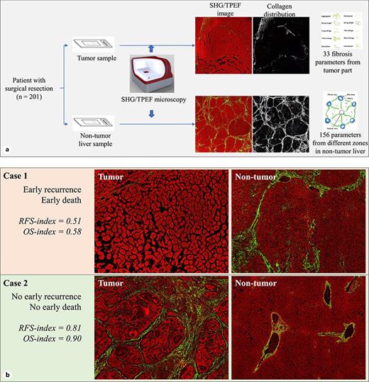 Illustration of methods. a Sample scanning and image quantification using SHG/TPEF microscopy. Total 33 and 156 fibrosis parameters were quantified from tumor and non-tumor part, respectively. b SHG/TPEF images show different patterns of collagen for early and no early recurrence/death cases.