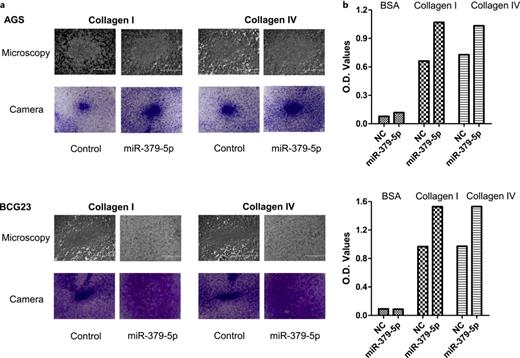 Effect of miR-379-5p mimic in gastric cancer cell adhesion to ECM. a Representative images under microscopy and camera of cell adhesion to certain ECM including collagen I and collagen IV. b Colorimetric O.D. values of cell adhesion to collagen I and collagen IV of adhesion assay. BSA was applied as a blank control.