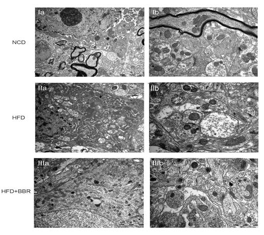 Fig. 6. The ultrastructural changes of hypothalamus revealed by transmission electron telescope. Ia NCD: the nucleus and organelles. Ib NCD: the neuropil and axonal synaptic bouton. IIa HFD: the nucleus and organelles; the shrinked nuclear membrane, scattered nucleoli and swollen mitochondria. IIb HFD: the swollen axonal bouton and fuzzy synaptic cleft. IIIa HFD+BBR: the structural destruction of nucleus and organelles were alleviated. IIIb HFD+BBR: the structure of axonal bouton and synaptic cleft were ameliorated by BBR administration. Scale bars in Ia, IIa, IIIa : 2 µm; Ib, IIb, IIIb: 1 µm.