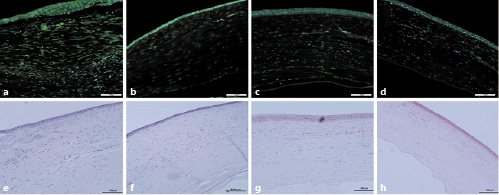 Fig. 6. Photographs of immunofluorescence staining with anti-VEGF antibody (green) compared to hematoxylin and eosin staining in right eyes of representative rabbits from the study groups: (a + e) aflibercept; (b + f) betamethasone; (c + g) aflibercept + betamethasone; (d + h) saline.