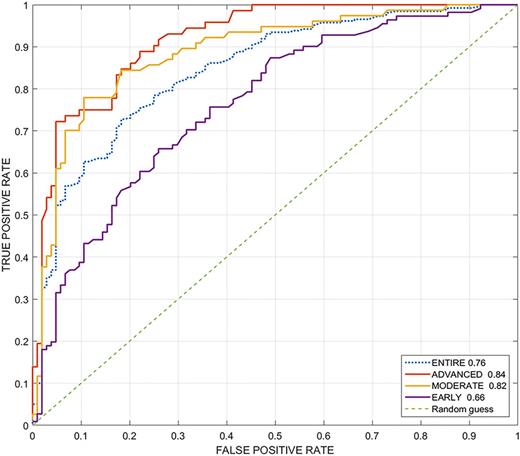 ROC curve for prediction task for the first experiment. The dashed line shows the global AUC for the entire dataset and the other lines show the AUC for each glaucoma stage.