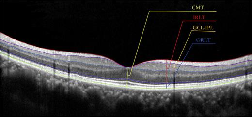 Layered architecture of the retina.
