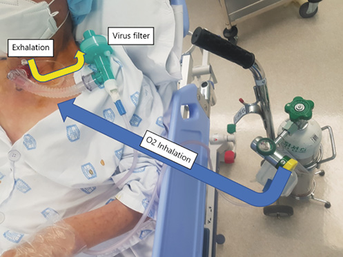 Fig. 2. Using a closed ventilation system with a virus filter to transfer the patient to the ICU negative-pressure room.