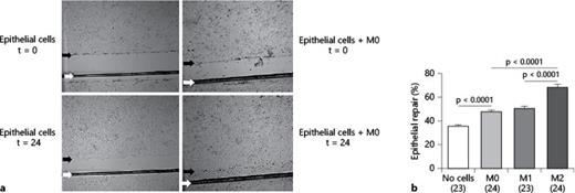 Fig. 2. M0, M1 and M2 macrophages promote in vitro intestinal epithelial repair. a Confluent epithelial cell monolayers were wounded with a razor blade and cultured for 24 h in the absence (left) or presence (right) of 2.5 × 105 M0 macrophages. Arrows indicate the limits of the wounded area. b Graphic rendition of wound closure data of 3 independent experiments. Data are expressed as means ± SEM, with the number of wounds used to determine the repair activity of macrophage subtypes in parentheses. p values were calculated using the Mann-Whitney U test.