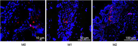 Fig. 3. M0, M1 and M2 macrophages home into the inflamed colon mucosa equally. On day 3 of DSS exposure, mice were injected intravenously with 1 × 106 PKH-26-labeled M0, M1 or M2 macrophages. Twenty-four hours later, the recovered colons were rolled up in ‘Swiss rolls' and frozen in OCT compound. Cryosections were stained with DAPI to identify the cell nuclei (blue) and were analyzed with a fluorescence microscope to localize PKH-26-labeled macrophages (red).