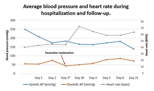 Fig. 3. Diagram illustrating trend over average systolic BP (blue line), diastolic BP (orange line), and heart rate (gray line) during hospitalization and at follow-up 21 days after admission. *indicates before PM implantation and #after PM implantation. BP, blood pressure; PM, pacemaker.