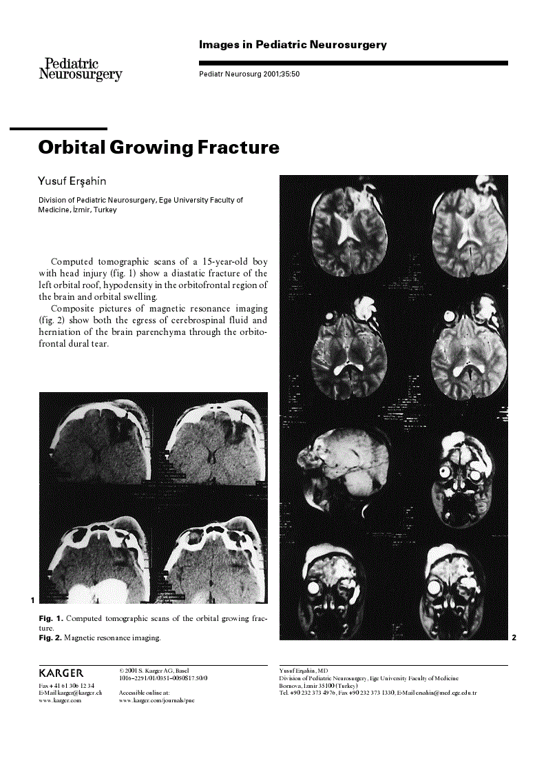 First page of Orbital Growing Fracture
