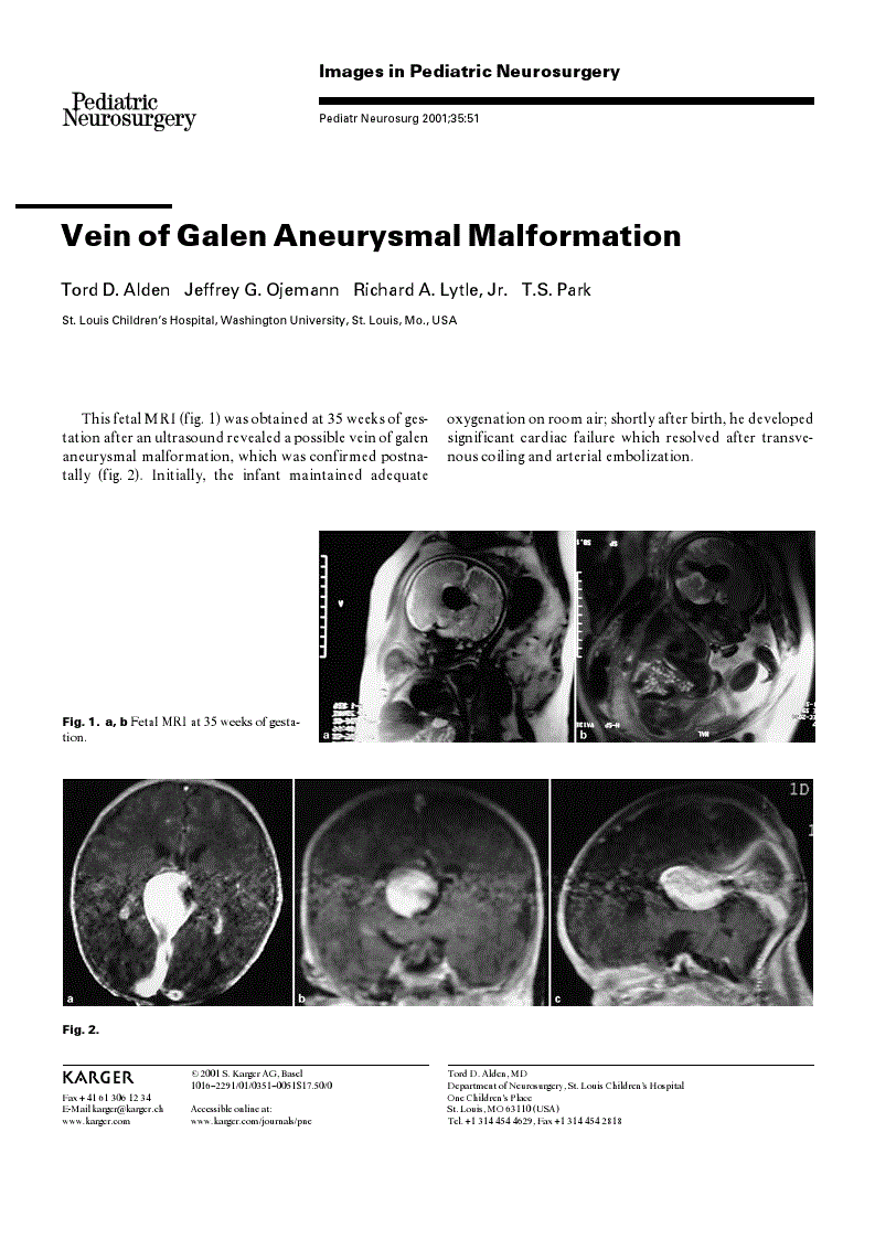 First page of Vein of Galen Aneurysmal Malformation
