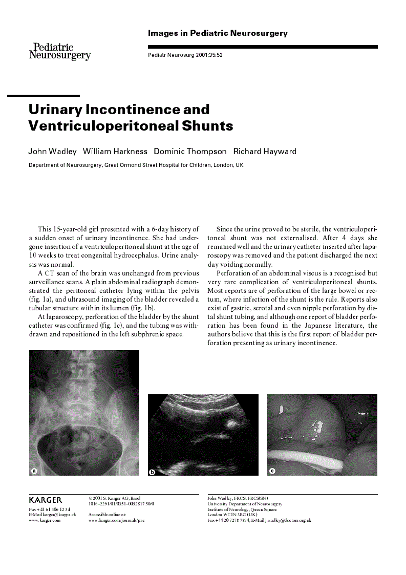 First page of Urinary Incontinence and Ventriculoperitoneal Shunts