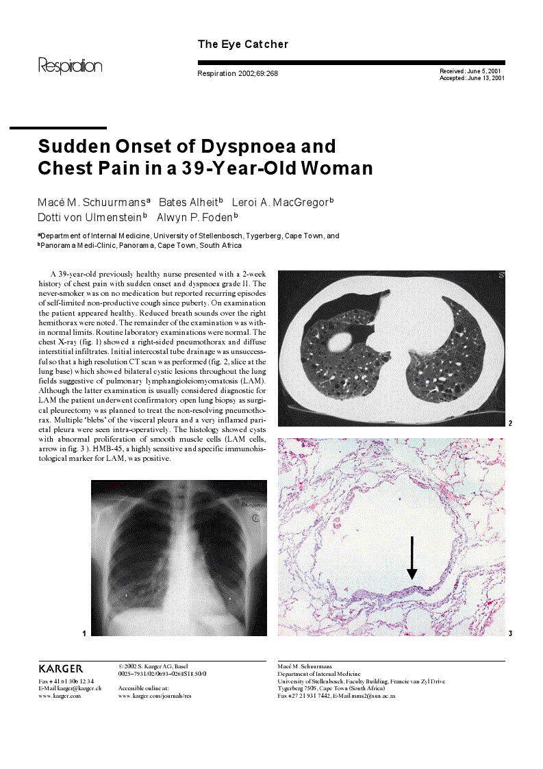 First page of Sudden Onset of Dyspnoea and Chest Pain in a 39-Year-Old Woman