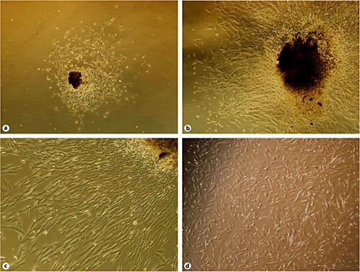 Fig. 1. Morphology of fibroblasts isolated from human airway granulation tissue. a Three days after explantation, fibroblast-like cells were observed to migrate from the tissue piece. The cells were a typical elongated spindle shape with a large cell body and a strong refraction index. ×40. b, c Eleven days after explantation, a large number of cells migrated from the tissue piece and formed a monolayer. The cells were typically elongated and spindle-shaped. ×40, ×100. d The passaged cells adhered to the flask rapidly and extended gradually. The morphology of the cell was still a typical elongated spindle shape and the cells were healthy.