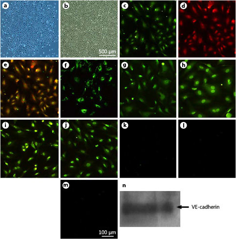 Fig. 1. Morphology and characterization of ECFC. Small colonies appeared after 1-2 weeks in cultures of MNCs (a). ECFC with cobblestone-like morphology were selected, passaged and grown to confluence (b), shown to endocytose DiI-acLDL (c) and bind UEA-1 (d). Merged image of both stains (e). ECFC expressed vWF (f), KDR (g), CD105 (h), CD146 (i) and CD144 (j) but did not express CD11b (k), CD14 (l) and CD45 (m). The expression of CD144 (VE-cadherin) was also verified by Western blot (n).
