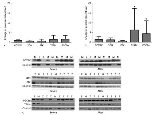 Fig. 4. Protein content. Western blotting analysis showed the change of energy metabolism key proteins COX IV, SDH and PFK, and mitochondrial signalling parameter (PGC1α and TFAM) due to PR training in 9 PiZZ (a) and 10 PiMM (b) COPD patients. TFAM and PGC1α increased significantly due to PR training in PiMM (p < 0.05) but remained unchanged in PiZZ patients. c Some representative blots for COX IV, SDH, PFK, PGC1α, and TFAM (control: tubulin) from 10 PiMM and 9 PiZZ patients are shown.