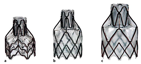 Fig. 8. Currently available sizes of Zephyr® endobrochial valves (EBV, Pulmonx) designed to occlude varying bronchial airway lengths, with diameters between 4.0 and 8.5 mm. a EBV-TS-4.0-LP. b EBV-TS-4.0. c EBV-TS-5.5.