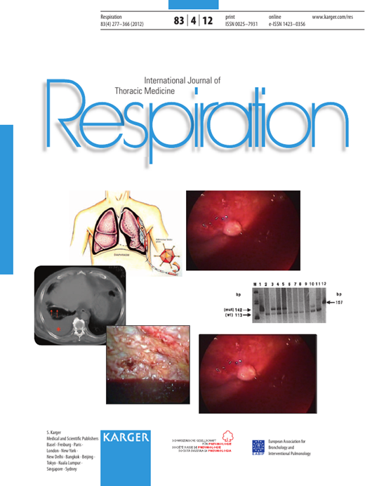 Intramural Hematoma of the Pulmonary Artery and Hemopneumomediastinum