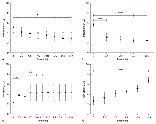 Fig. 3. Timing of onset and offset of analgesia in response to DBS at the PAG and CmPf nucleus in anaesthesia dolorosa subjects. a Mean pain score against time after PAG stimulation is switched on (p = 0.03, F = 3.1, d.f. = 7). b Mean pain score against time after CmPf stimulation is switched on (p = 0.0002, F = 21.9, d.f. = 4). c Mean pain score in response to PAG stimulation being stopped (p = 0.01, F = 5.5, d.f. = 5). d Mean pain score in response to CmPf stimulation being stopped. (p = 0.01, F = 5.7, d.f. = 5). SE bars are provided at each mean pain score. * p < 0.05, ** p < 0.01, *** p < 0.005, referring to sub-analysis using Sidak's test.