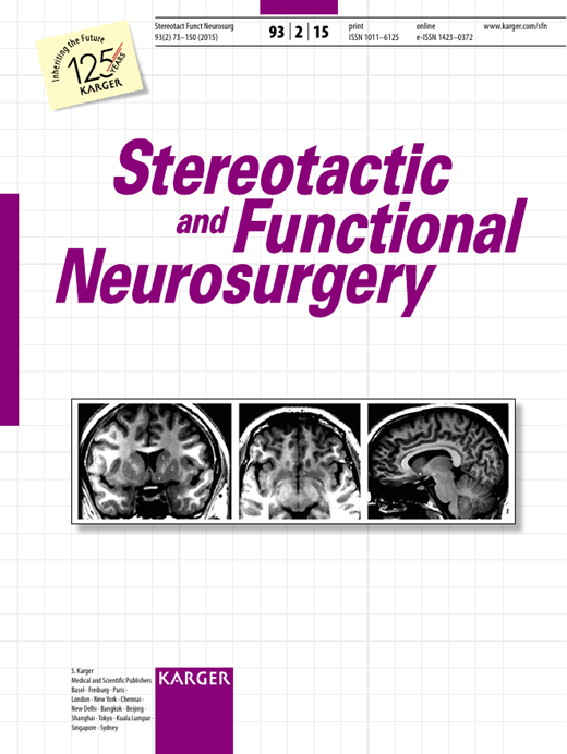 Gamma Knife Stereotactic Radiosurgery for Trigeminal Neuralgia Caused