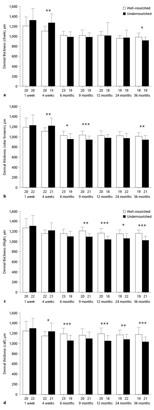 Fig. 2. Comparison of dermal thickness in well-nourished and undernourished infants in the 7 age groups. The values are shown as mean + SD. The number in each group is shown beneath the respective bar. * p < 0.05, ** p < 0.01, *** p < 0.001.