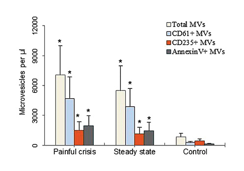  Quantification of different MVs in SCD patients and controls. Total count of different MVs according to the expression of CD61, CD235a, and Annexin-V that represents platelet, erythrocyte, and procoagulant MVs, respectively. Plot revealed a statistically significant increase of MVs in painful crisis and steady state compared to controls (*p< 0.001 by ANOVA). Results are mean ± SD.