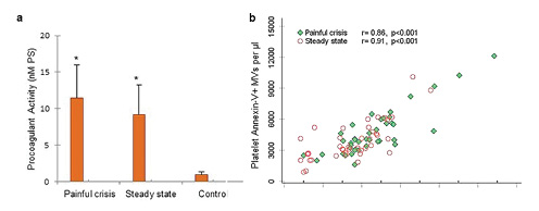  Assessment of procoagulant activity due to PS-expressing MVs and its correlation with the number of Annexin-V+ MVs in SCD patients. a Procoagulant activity of collected samples in SCD patients compared to control. There was significant difference between procoagulant activity in painful crisis compared to steady state and control (*p< 0.001; by paired ttest). b Correlation of Annexin-V+ MVs and procoagulant activity measurements. Change in the number of Annexin-V+ MVs correlated with the change in procoagulant activity in painful crisis (r= 0.86, p< 0.001 by Pearson’s test) and steady state (r= 0.91, p< 0.001 by Pearson’s test).