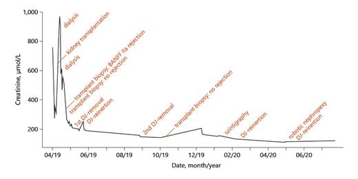 Fig. 1. Course of creatinine.