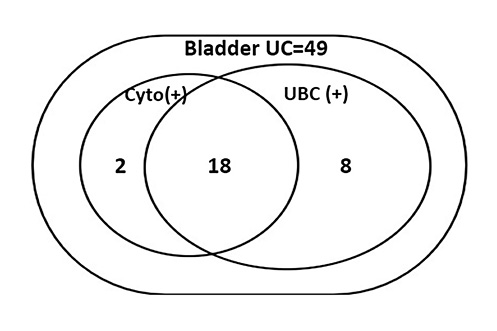  Venn diagram of UBC®Rapid-positive bladder UC (26 cases) and cytology-positive bladder UC (20 cases). Note that 21 bladder UC were nondetectable by either UBC®Rapid or urine cytology.