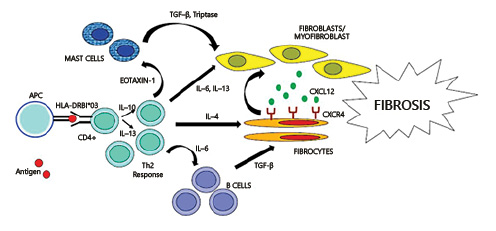  Pathogenesis of IRF. The development of the disease is related to the combination of a particular genetic background (i.e., HLA class II alleles) and exposure to environmental agents. Antigen-presenting cells present a hypothetical antigens to retroperitoneal T-helper cells. Th2 responses produce IL-4, which directly activates fibroblast, and IL-10, IL-13, which drive B-cell expansion and maturation into plasma cells. Lymphoid cells also secrete eotaxin-1, which recruits mast cells, whose degranulation products are also able to activate fibroblasts. Once activated, fibroblasts switch into myofibroblasts and secrete fibers of collagen. Finally, the CXCR4-CXCL12 axis plays a role in circulating fibrocyte recruitment into retroperitoneal tissues, perpetrating inflammation and fibrosis.